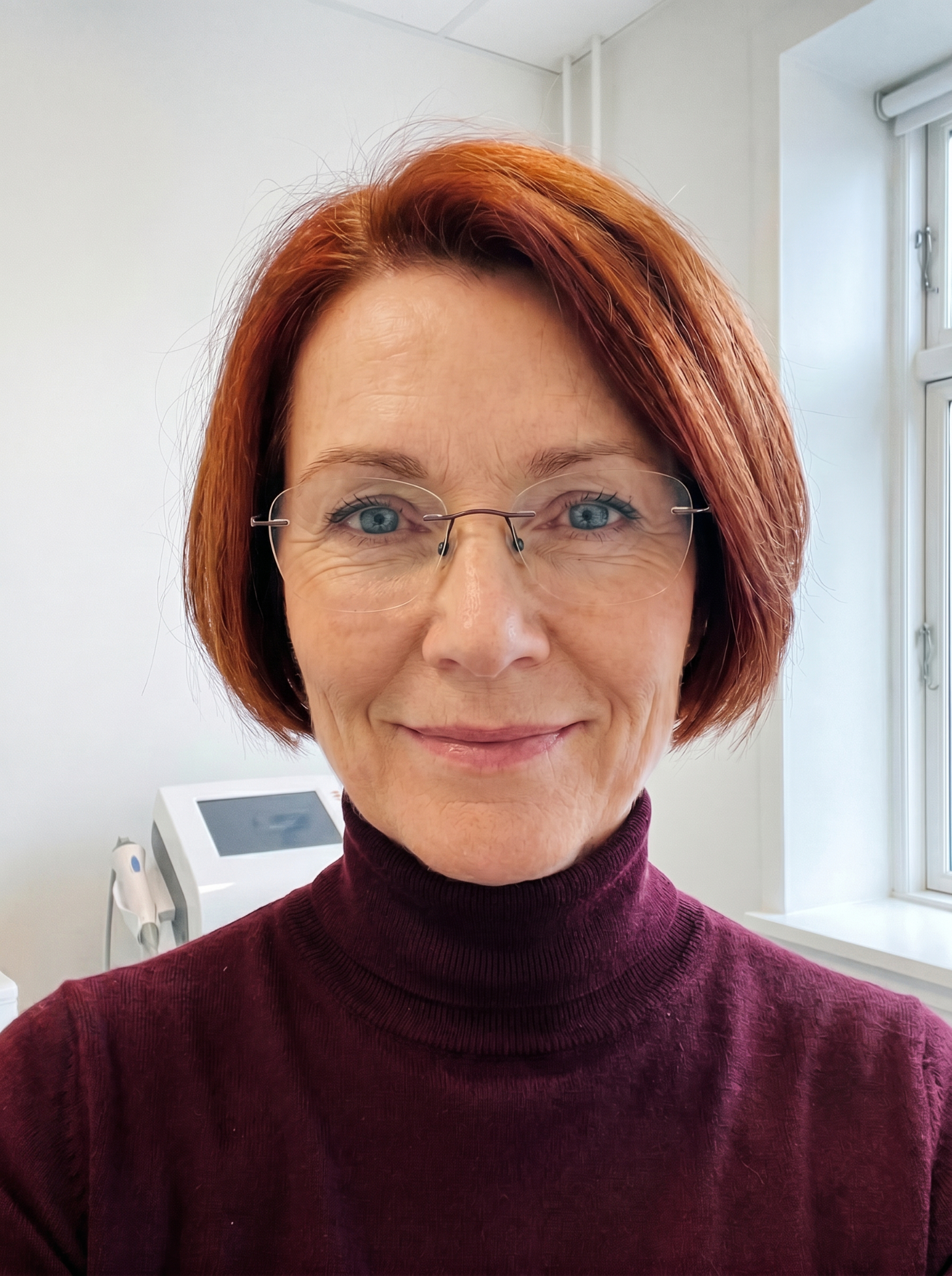 Klient efter ansigtsløft hos Beautiful Balance